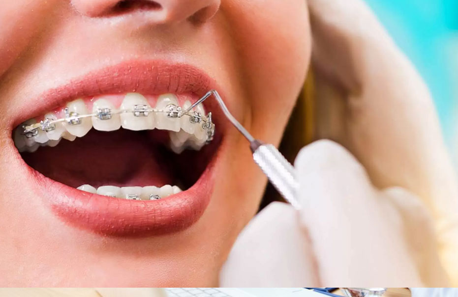 Ortodontia: Tudo o que você precisa saber