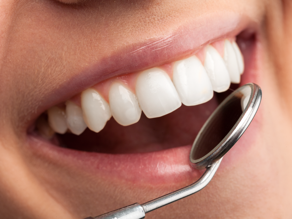5 principais tratamentos dentários e suas áreas