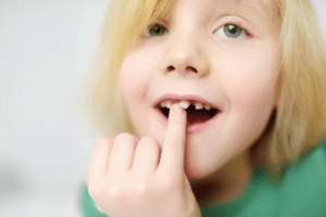 Como tirar os dentes de leite do seu filho do jeito certo?
